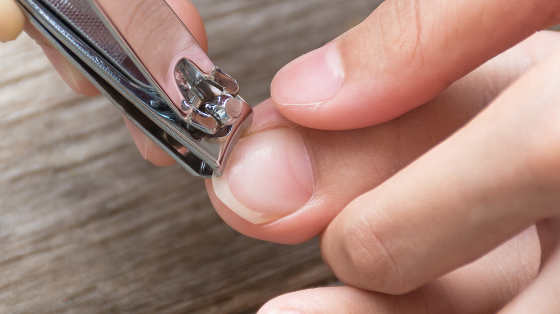 A legtöbben rosszul vágják a lábkörmüket – ezért alakul ki a benőtt köröm